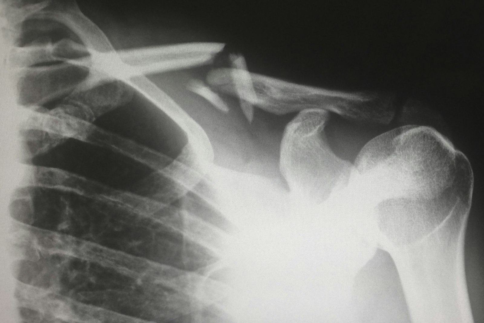 When Should You See an Orthopaedic Specialist?